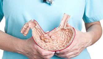 A doctor holds up an anatomical model of a stomach.