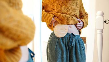 A woman showing her ostomy bag