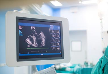 Echocardiogram in an operating room