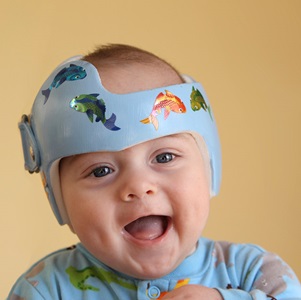Smiling baby wearing a helmet