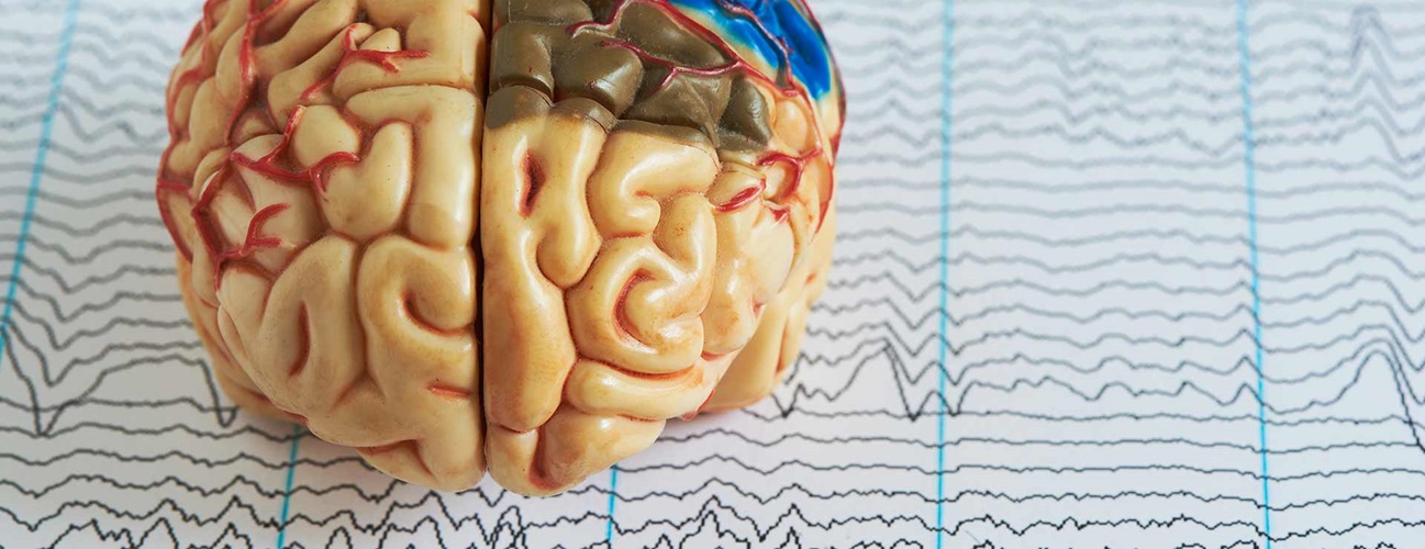 Eeg Brain Scan Eeg brain scan