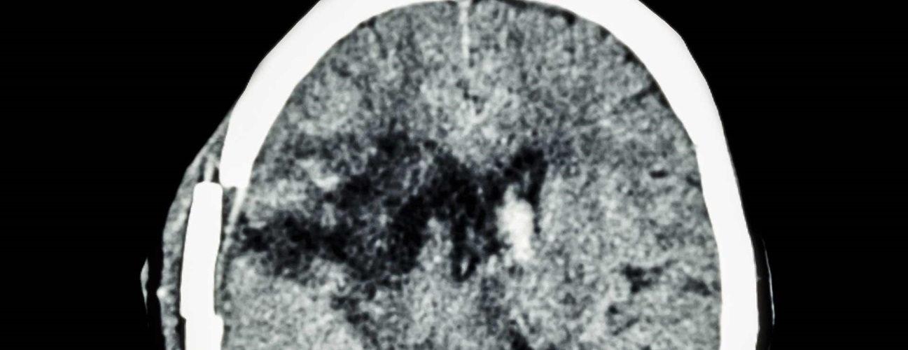 A brain scan.