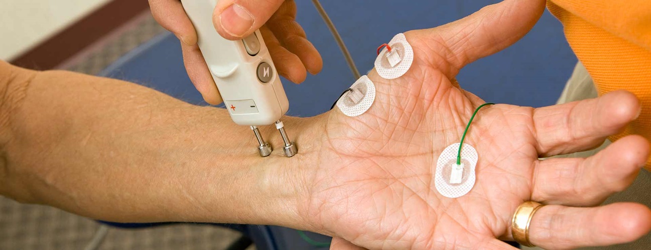 A patient with electrodes on their hands.