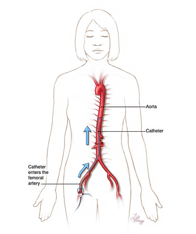spine pathway diagram