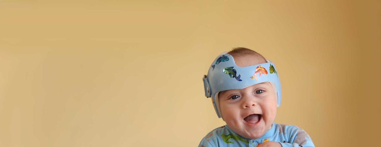 infant wearing helmet