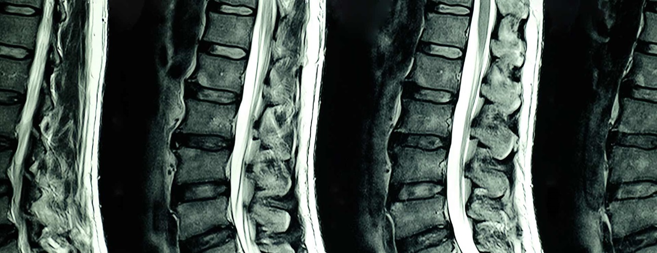 A series of spine images.