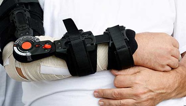 Patient with an brace applied to their arm.