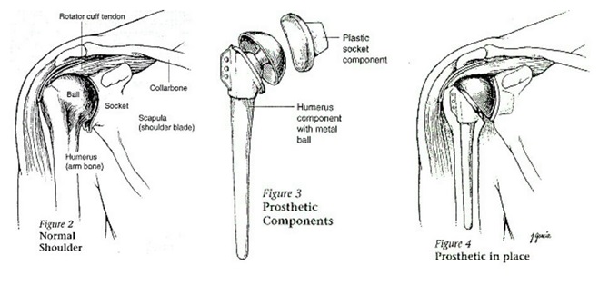 Full Shoulder Layout Shoulder Parts Diagram