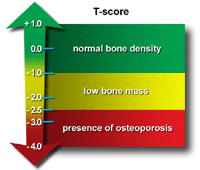 Bone Mass Density Chart