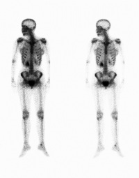 Image of scanned bones