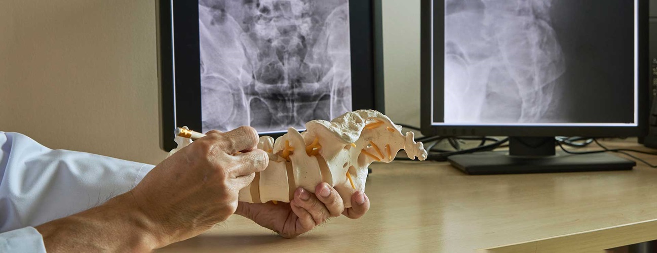 Doctor pointing to lumbar spine model with x-rays in the background.