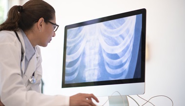 Radiologist examines chest x-ray