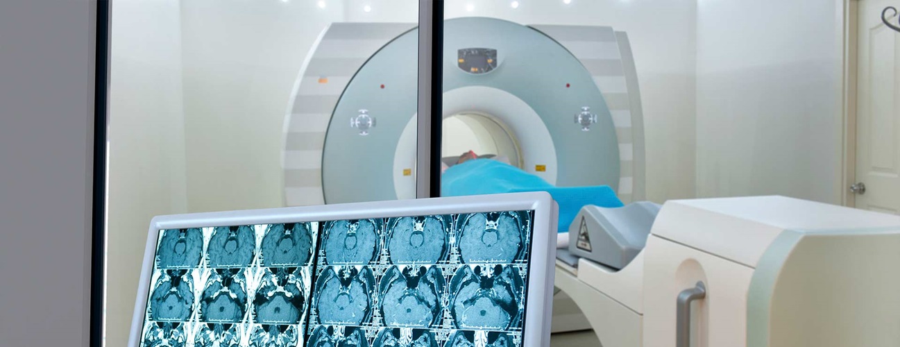 Brain scan shown on a computer monitor with a radiosurgery device in the background