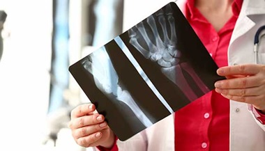 Doctor examining x-rays of wrist