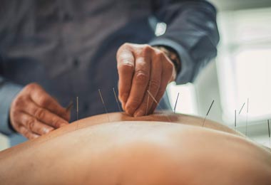 Acupuncturist working on a patient