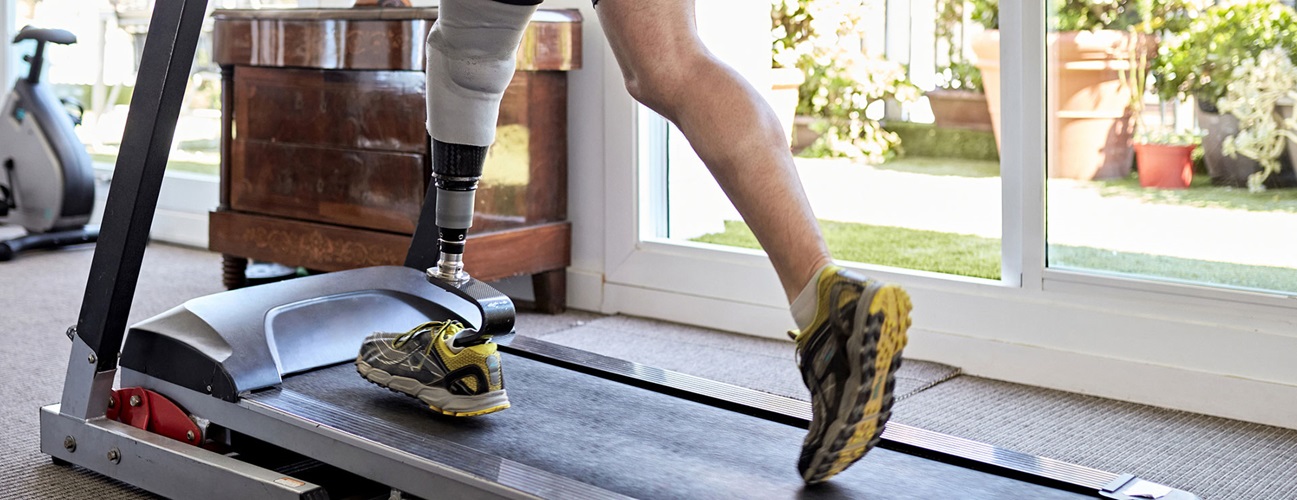 A man with a prosthetic leg walks on a treadmill