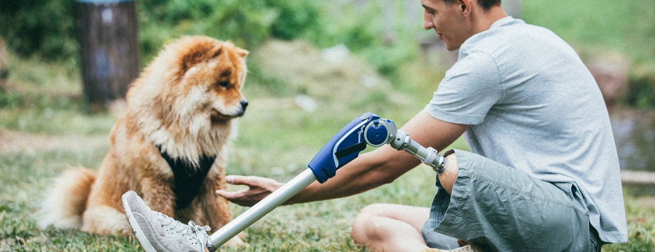 A man with a prosthetic leg sits outside with his dog