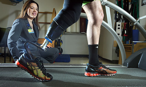 A physiatrist watches a lower-limb amputee walk on a treadmill with a prosthetic leg