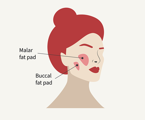 buccal fat pad illustration