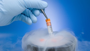 embryo freezing - close up of glove lifting frozen specimen with tweezers from container