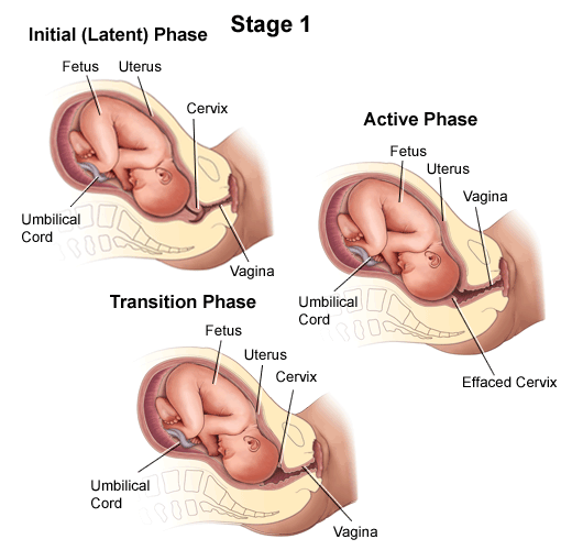 An illustration of the first stage of labor.