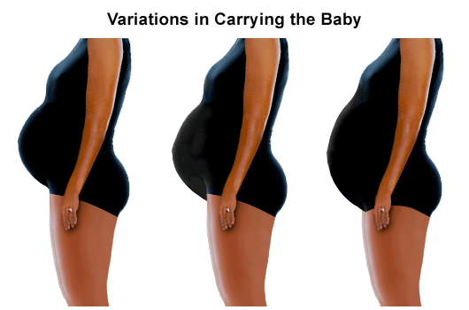 Variations in how a baby is carried during pregnancy.