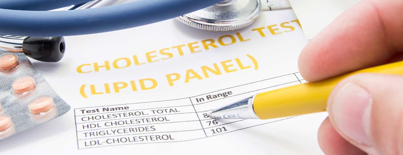 Doctor reviewing a lipid panel test for cholesterol