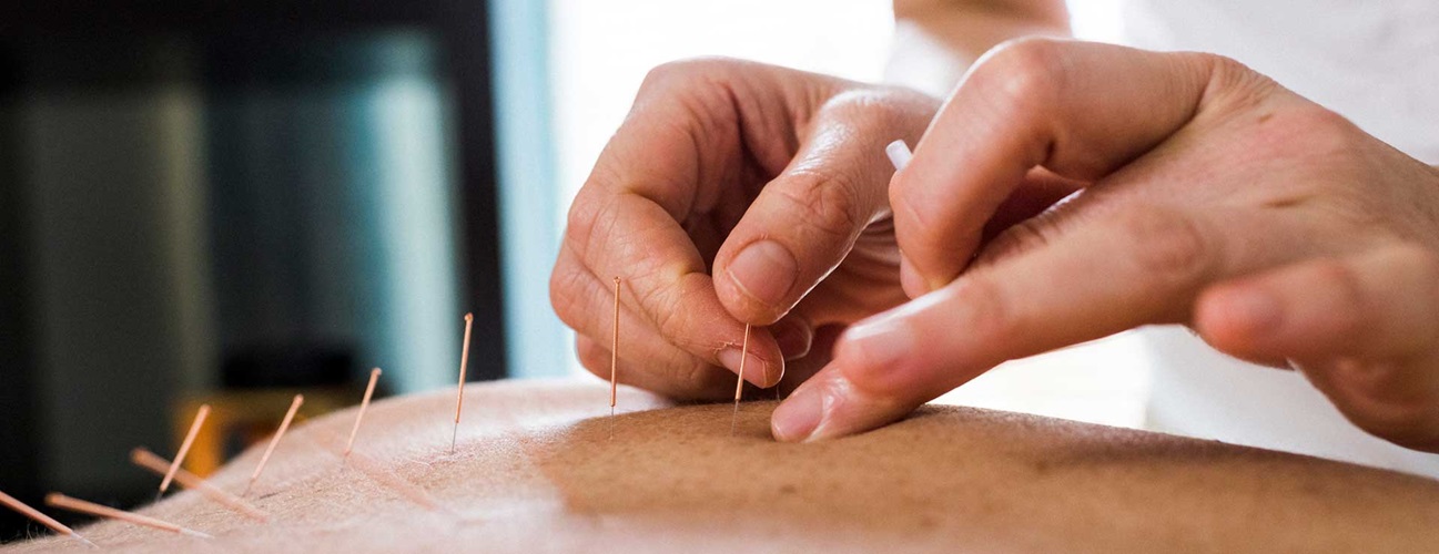 Acupuncture Point That Reduces Fevers Confirmed