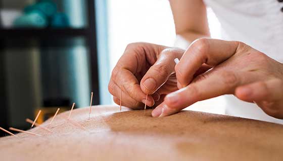 Acupuncture  Johns Hopkins Medicine