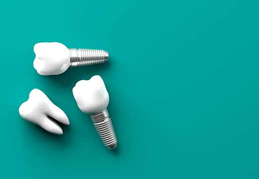 Dental implants lying on mat. 