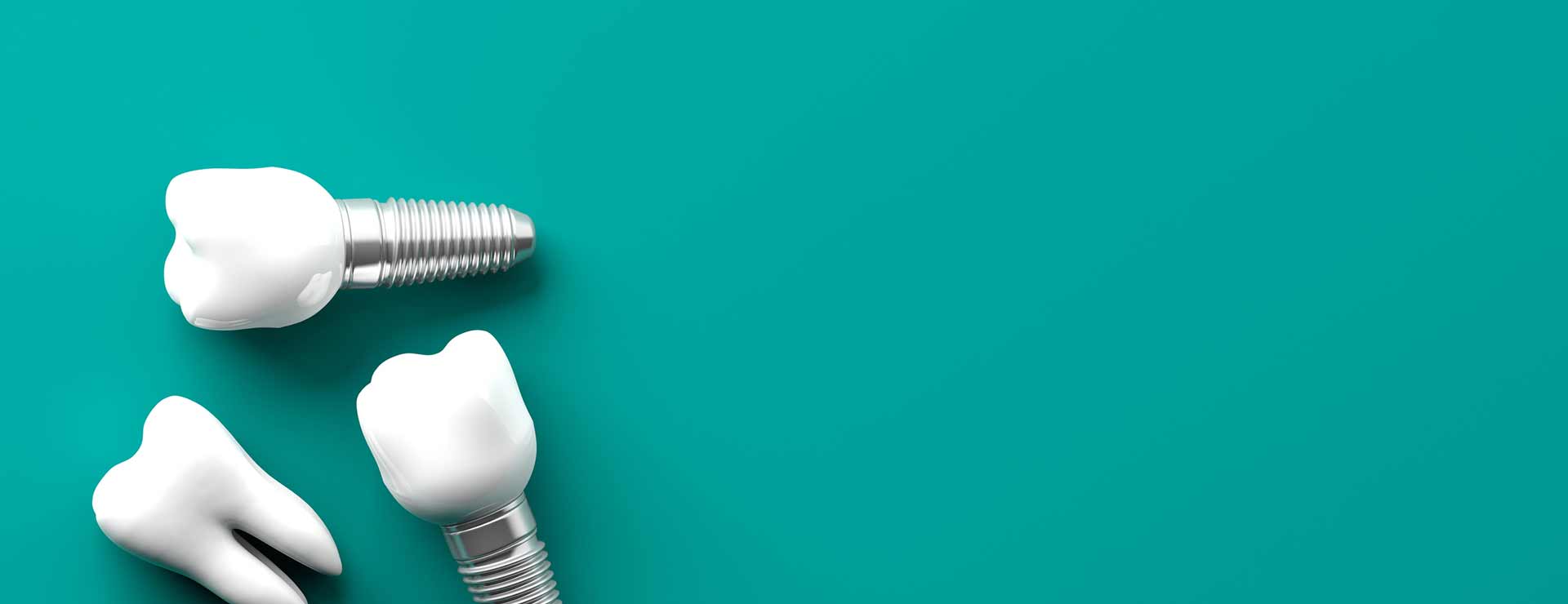Dental Implants.