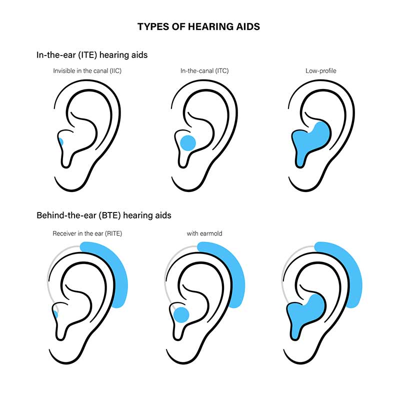 Hearing Aids  Johns Hopkins Medicine