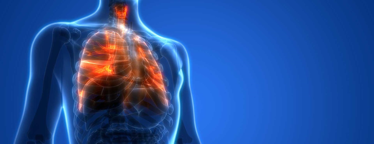 Lung Biopsy | Johns Hopkins Medicine