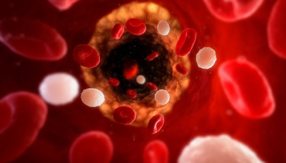 vascular