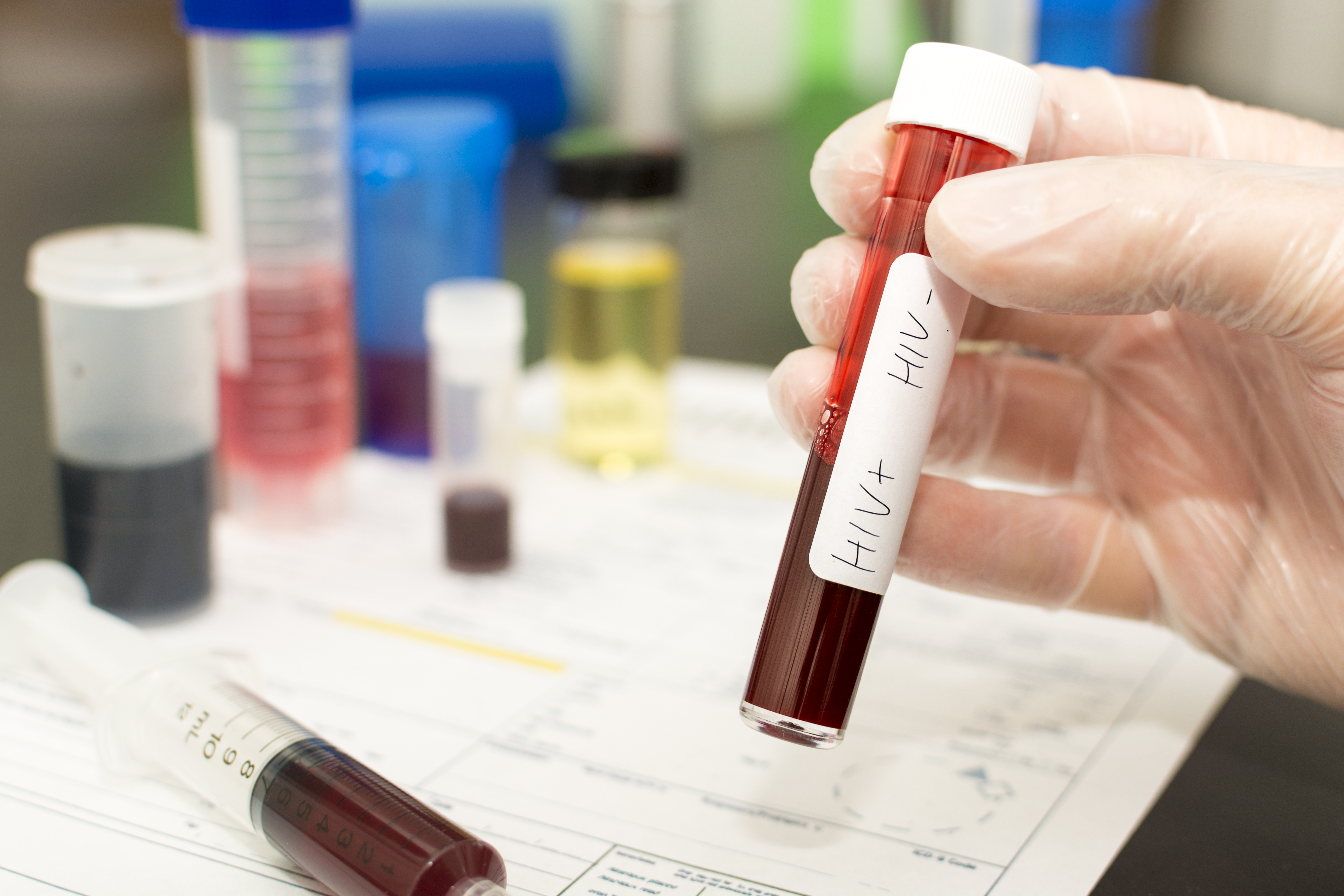 Кровь рв вич. Исследование крови на ВИЧ инфекцию. ВИЧ пробирка. Пробирки с кровью.