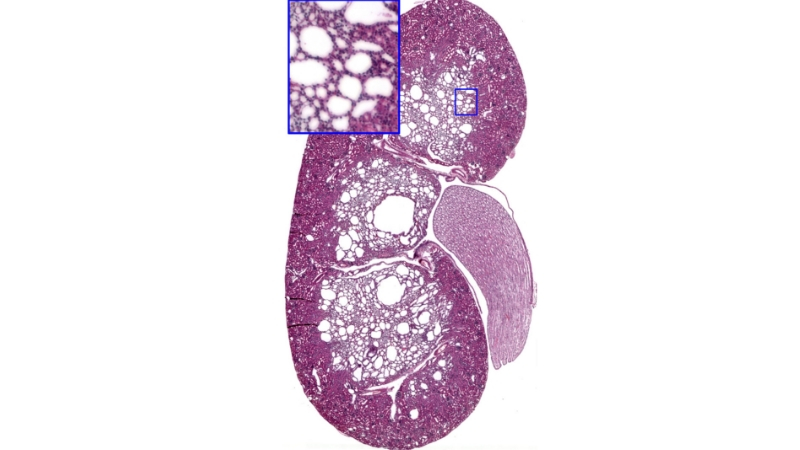800 Kidney_slice