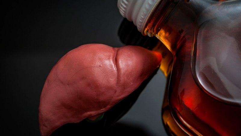 800 Liver_alcohol_ hepatitis_GettyImages-916300454