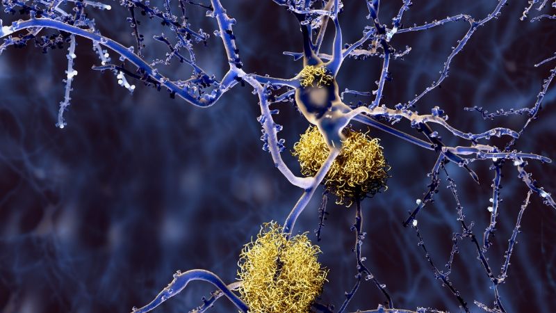 800 Alzheimers neurons