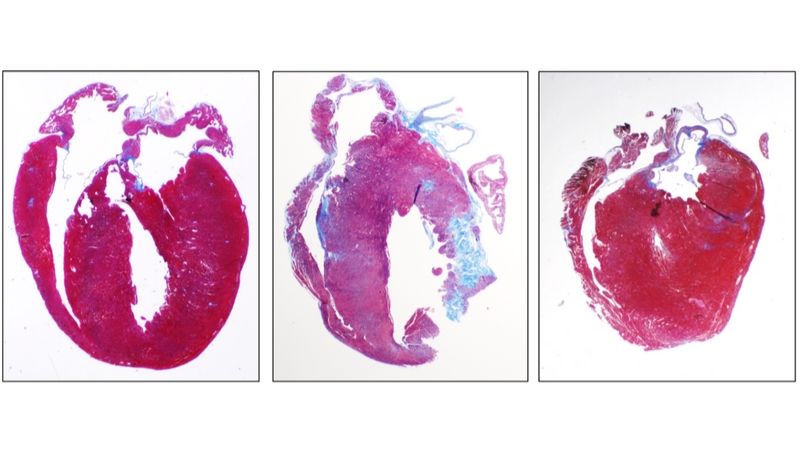 ipamorelin heart disease Risks of Unapproved Peptides for Health & Performance GLP-1s Outperform Insulin...again. , New