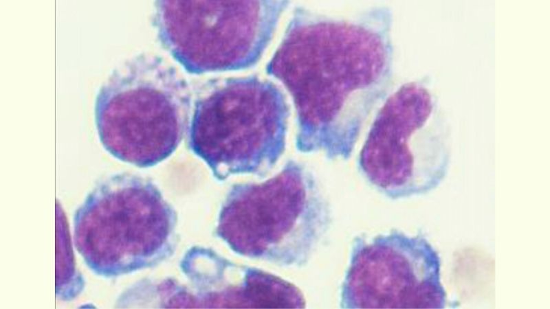 genetically-engineered-bone-marrow-cells-slow-growth-of-prostate-and-pancreatic-cancer-cells-in-mice