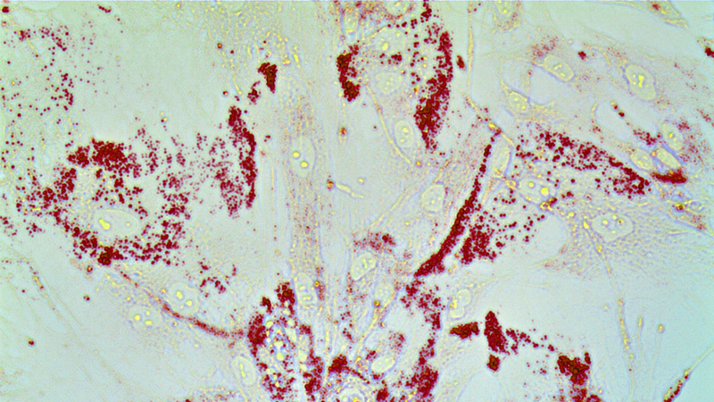 Cancer cells
