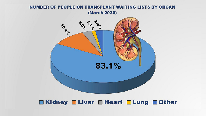 Kidney transplant