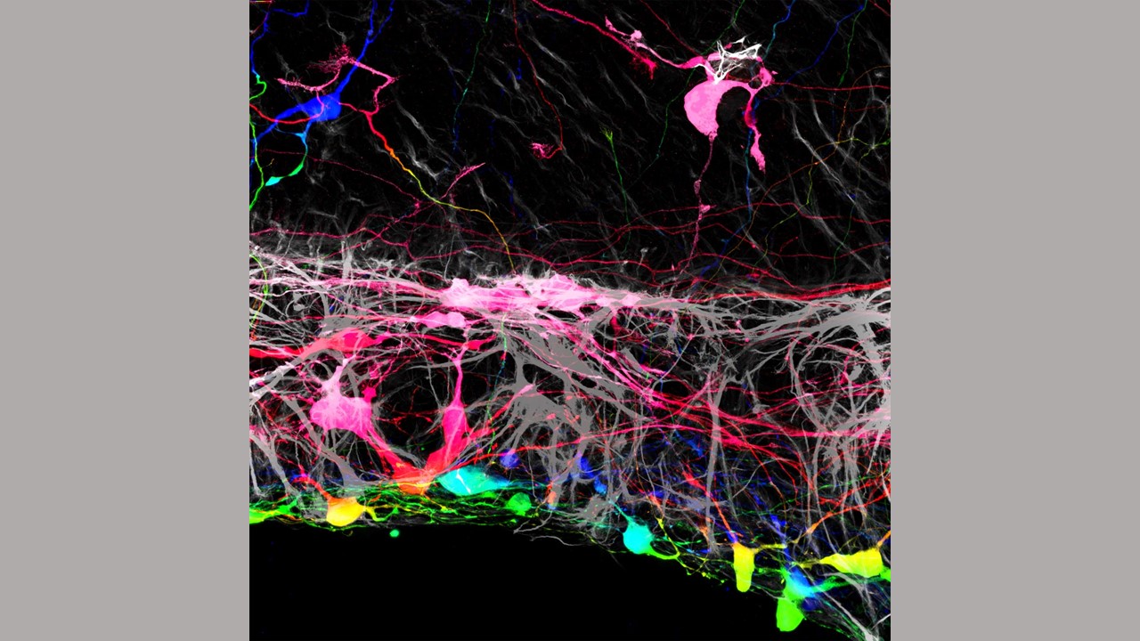 Retinal ganglion