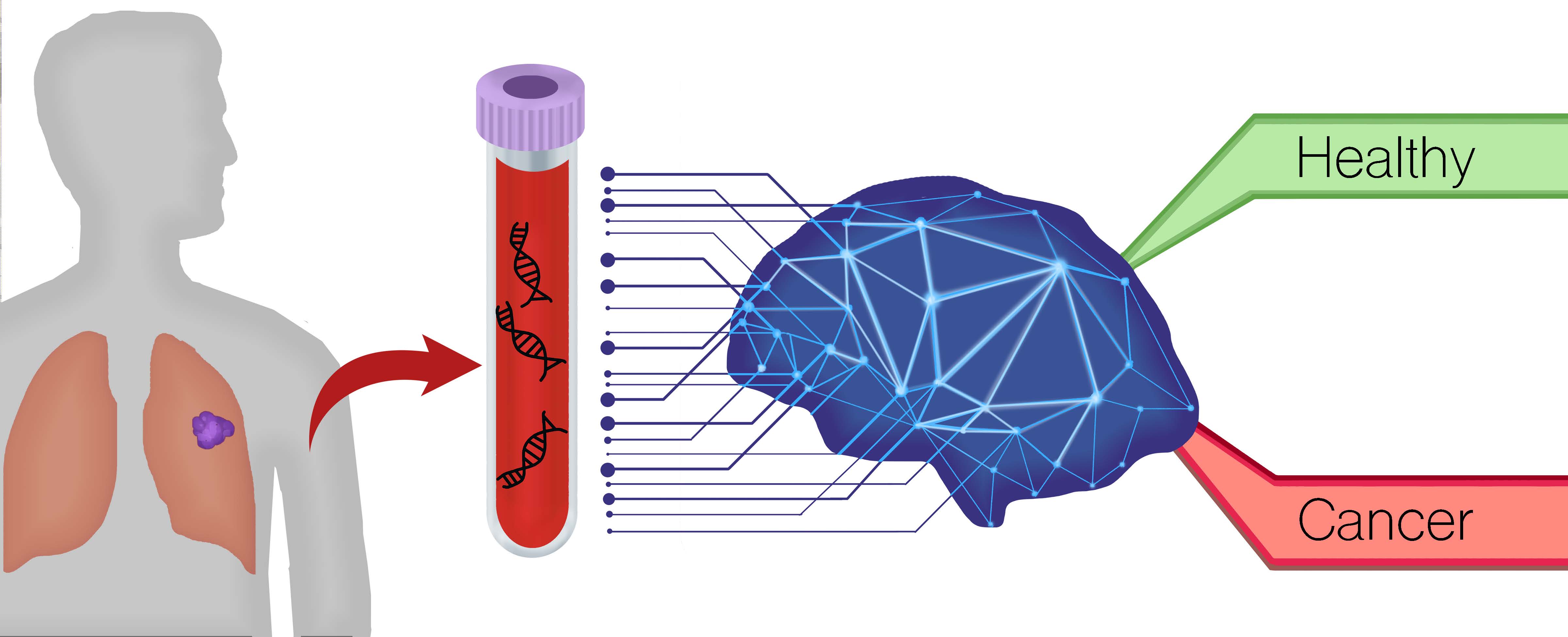 AI blood test could speed up diagnosis of brain tumours, say