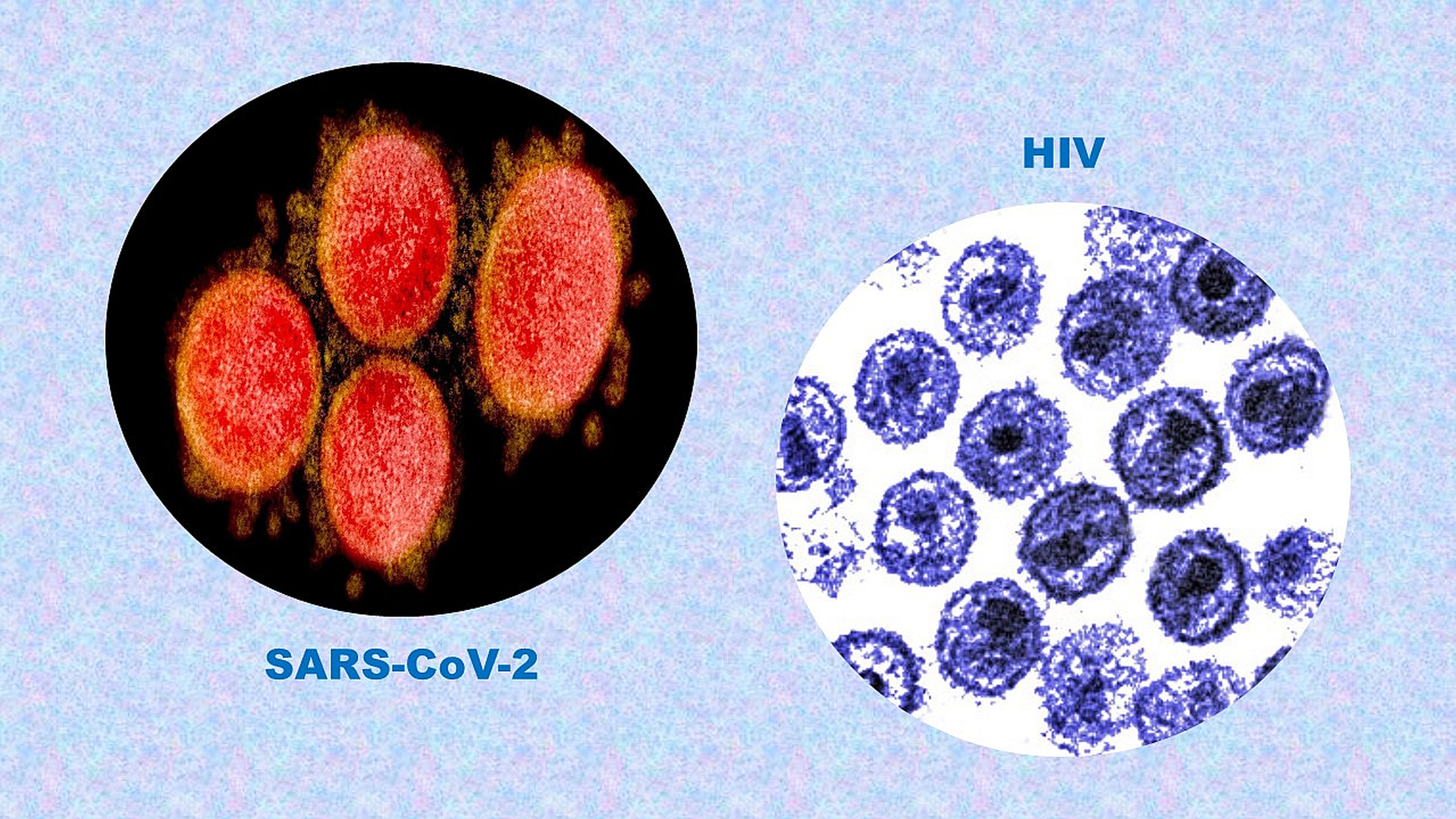 Living with HIV