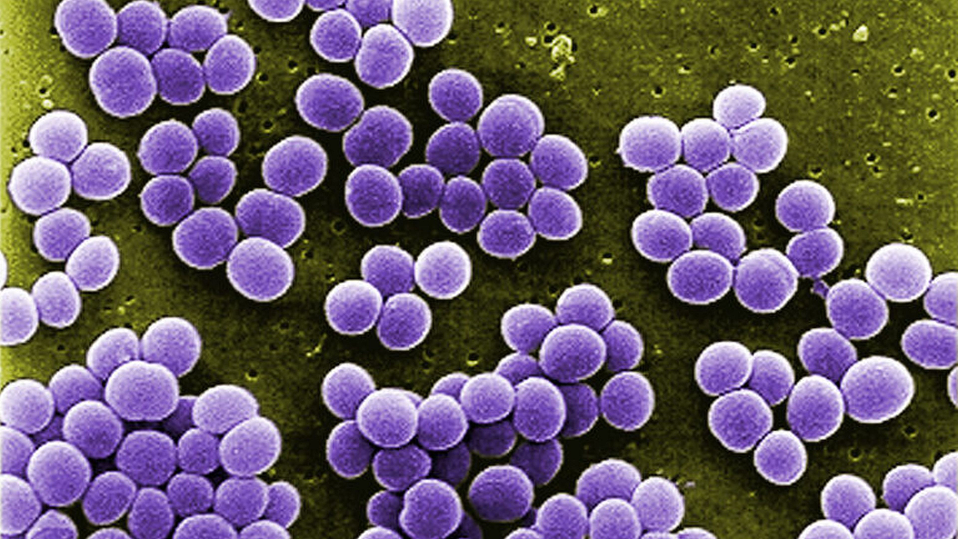 staphylocococcus aureus