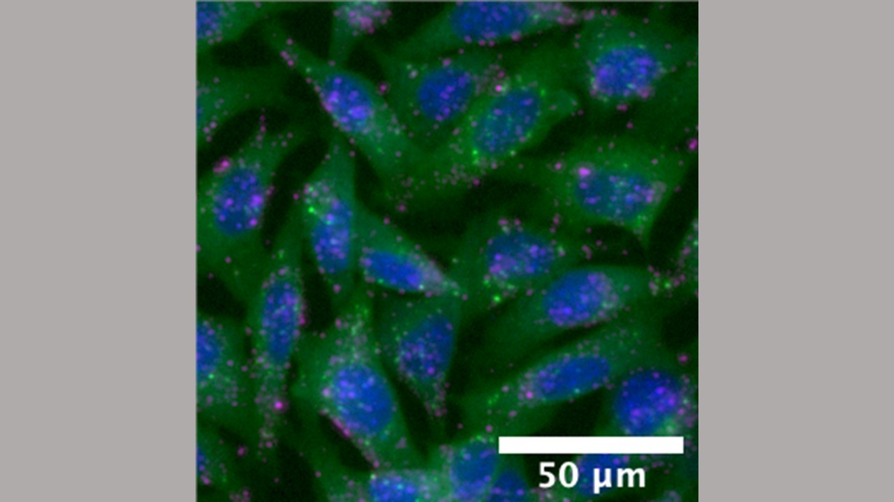 Polymer nanoparticles