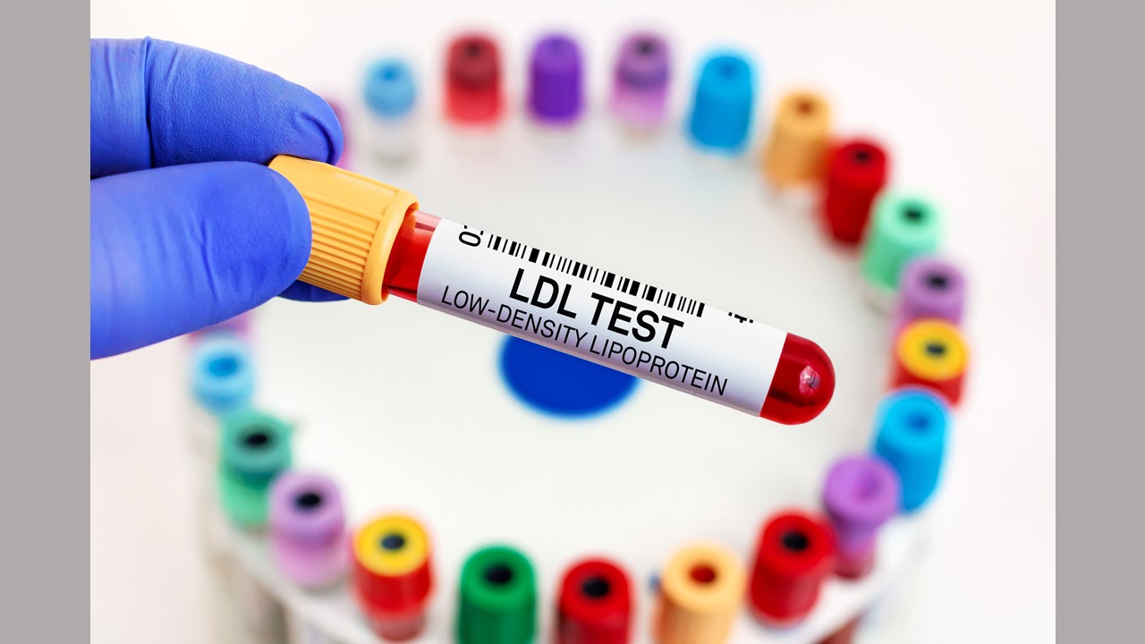 Cholesterol test