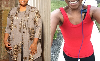 Lisa before (left) and after (right) losing 80 pounds