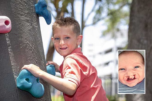 Two images of Logan. One as a baby and one as a young boy climbing a tree. 